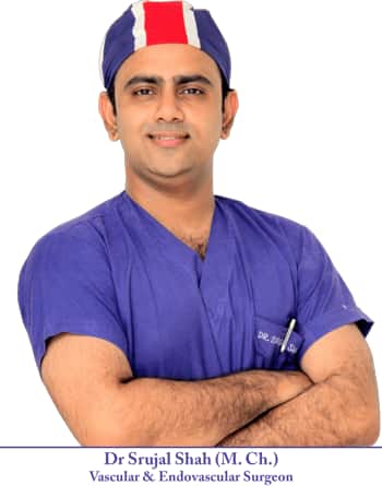 Best Vascular Surgeon in Ahmedabad
