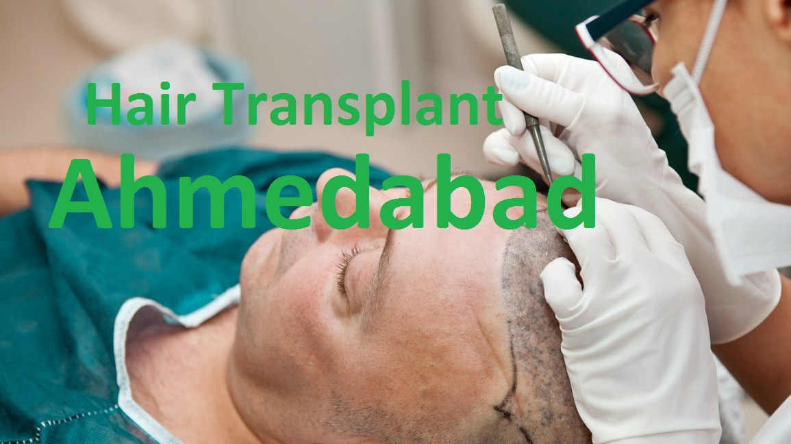 Best Hair Transplant in Ahmedabad - Cost-Effective Treatment
